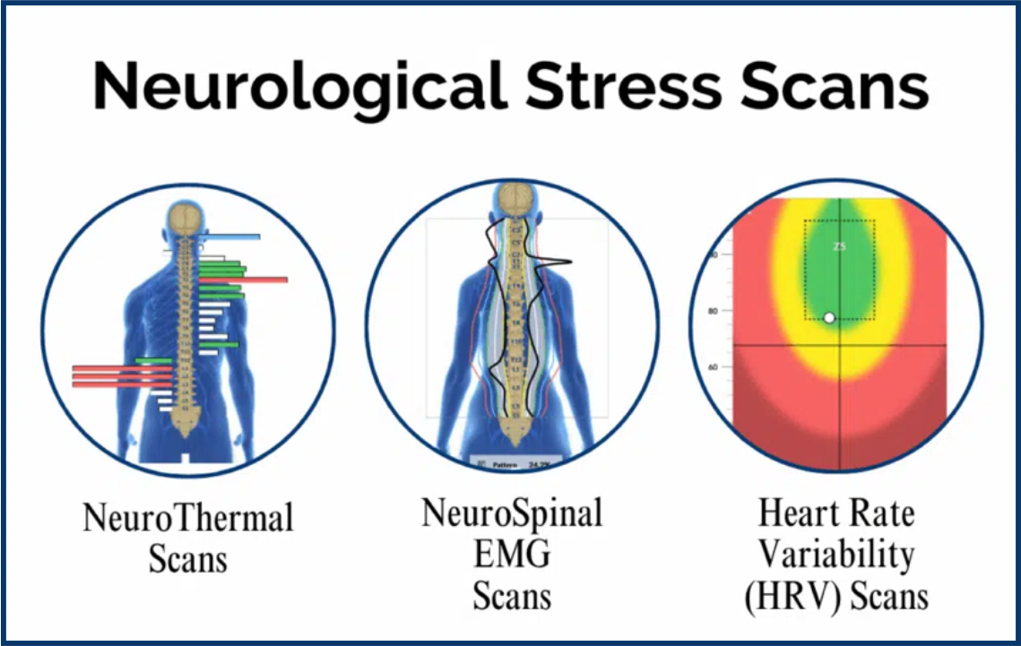 Neurological Stress Scans