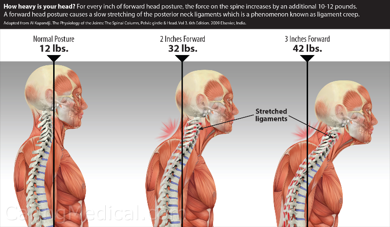 Posture