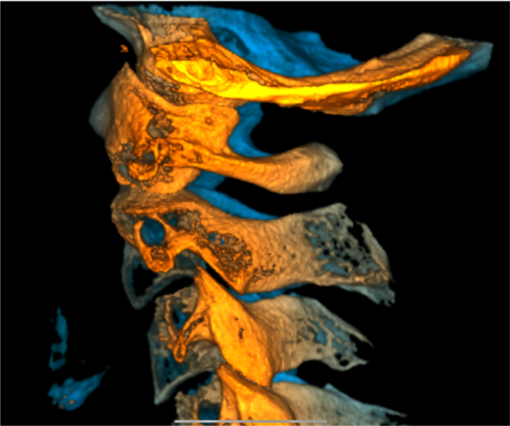 Spine left 1